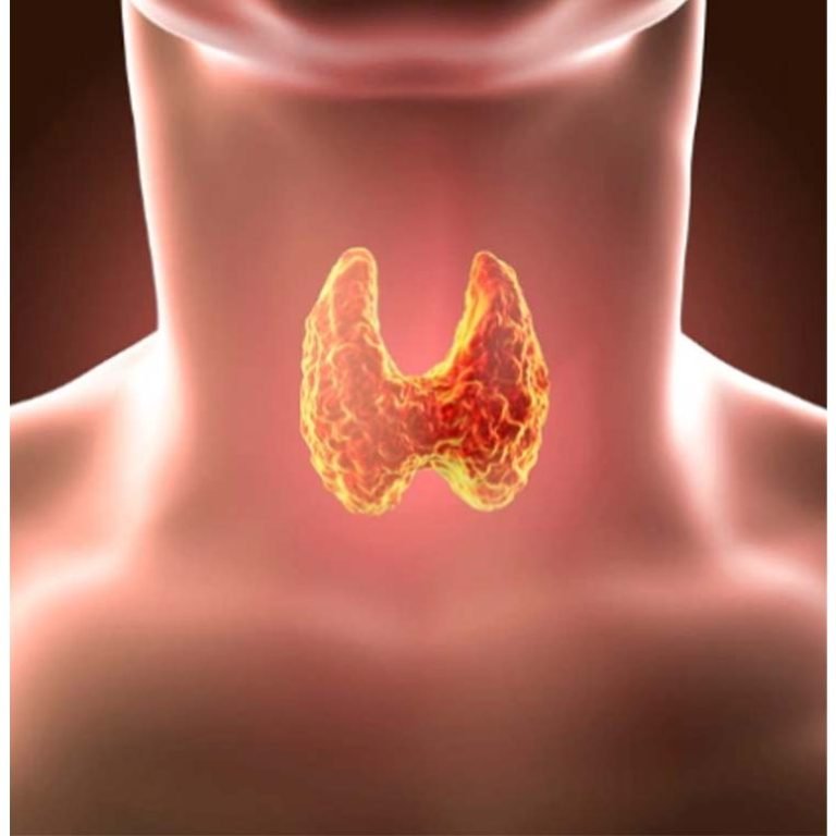 Tiroid Bezi Hastalıkları & Tümörleri